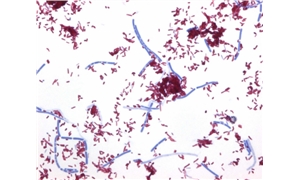 CARBOL FUCHSIN DILUTE [STAINING SOLUTION(ZIEHL NEELSEN)]